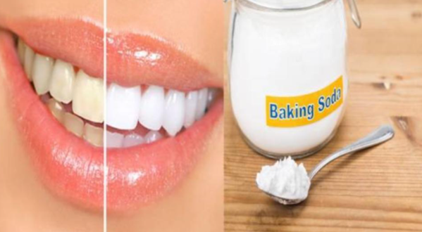 Gợi ý cách làm trắng răng bằng baking Soda